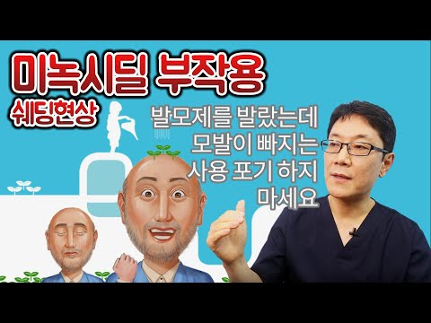 미녹시딜부작용 쉐딩현상 발모제 탈모치료약 계속 사용해야 할까요?