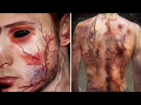 10 People Who Got Struck By Lightning