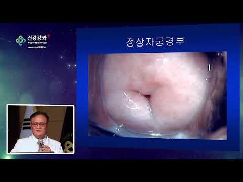부인암의 예방 및 조기진단
