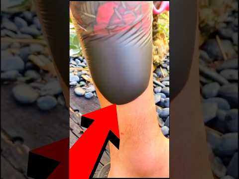 Perché il Tatuaggio fa Quella Bolla? 🤔 #shorts #perte