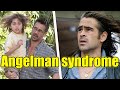 Colin Farrell discusses son's Angelman Syndrome