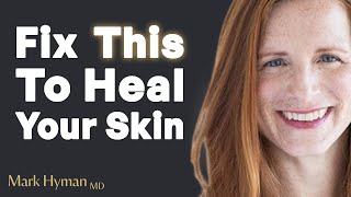 A Shocking Cause For Acne, Weight Gain, Hair Loss & Rapid Aging In Women | Dr. Elizabeth Boham