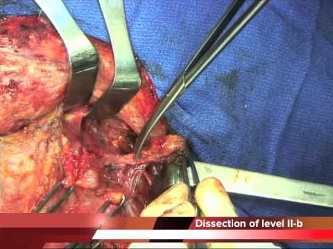 comment guerir de la tuberculose ganglionnaire