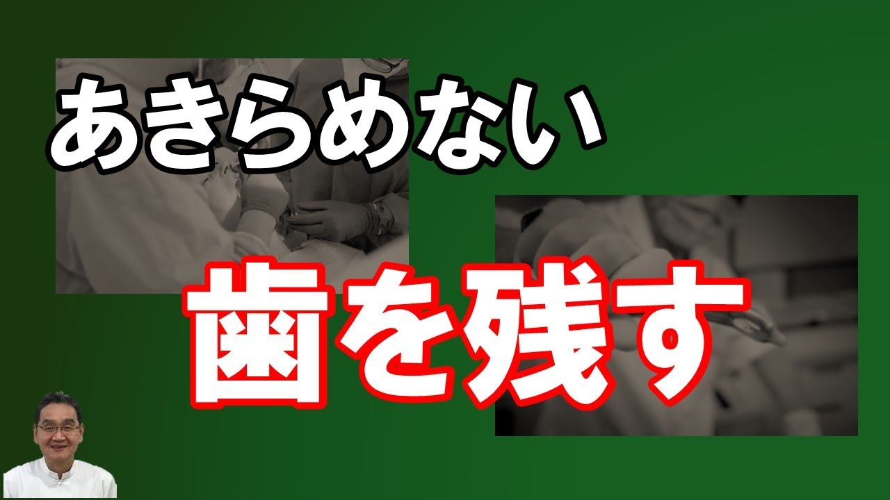 あきらめないで歯を残す