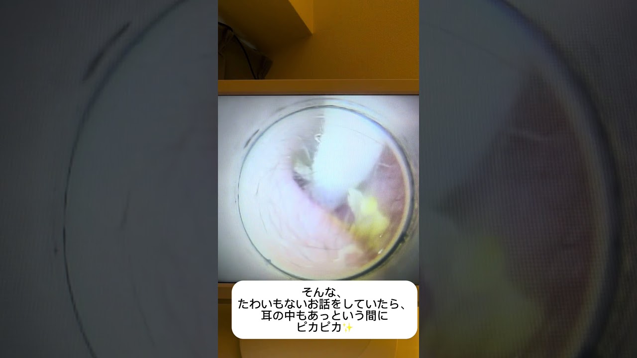 プロが解決！子どもの耳掃除🪞🧸      子どもコース：40分 6000円                       #子どもの耳掃除 #耳鼻科検診 # #耳掃除サロン #eariss