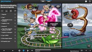 Membranoproliferative Glomerulonephritis