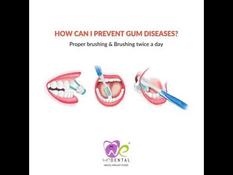 preventing  Gum diseases ideas by best dental hospital in coimbatore