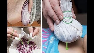 No One Ever Told You Onions Could Do These Miraculous Things To Cure!