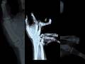 I Broke Little Timmy S Wrist In Gorilla Tag Vr Gorillatag Gtag Funny