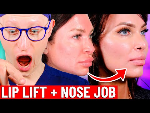 Lippenlifting in Kombination mit anderen Operationen – ist das möglich?