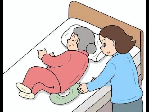 Pressure Ulcer | Bed sore | Decubitus/Plaster Ulcer Rule - ICD 10 CM| Dr Rams Medical Coding Academy