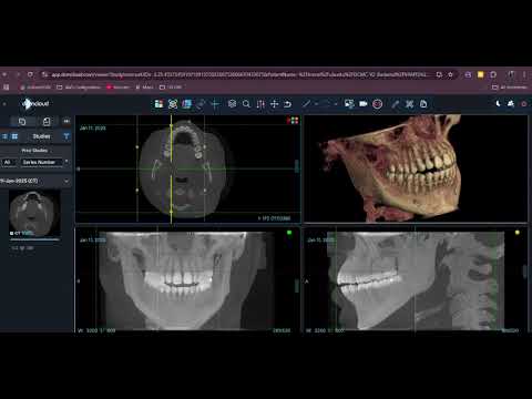 DCMCloud - New UI and Features Launching soon