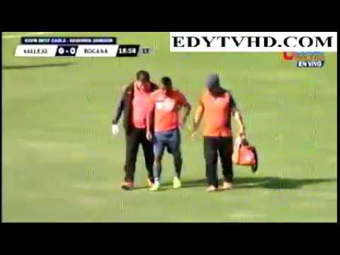 Universidad Cesar Vallejo 4  VS 2 Defensor  La Bocana  27/08/2017 WWW.EDYTVHD.COM