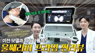 울쎄라피 프라임 리얼후기 기존 울쎄라랑 뭐가 다를까? 직접 시술해봤어요!