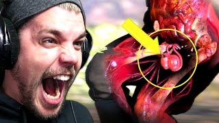 DOUBLE TESTICULES SHOT Sniper elite 4 