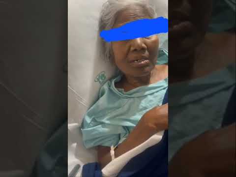 Mandibular Dyskinesia (Description by Dr Sudhir Kumar, Neurologist)