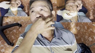 nhổ răng ảnh hưởng đến chức năng ăn nhai của bệnh nhân