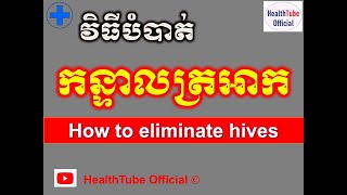 វិធីបំបាត់ កន្ទាលត្រអាក l How to eliminate hives l ជំងឺស្បែក ll  @healthtubeofficial