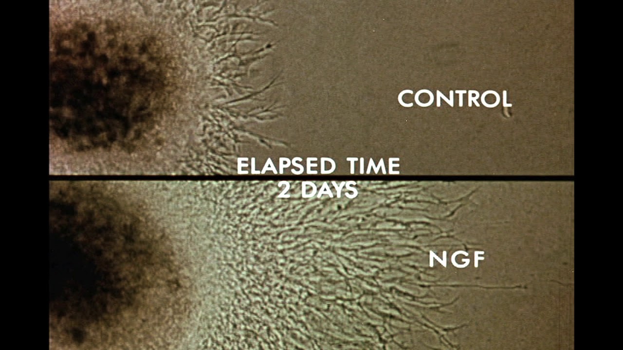 8.  Response of Cells to Nerve Growth Factor (NGF) - YouTube
