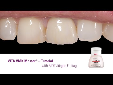 EN | VITA VMK Master® Tutorial | Step-by-Step with Jürgen Freitag