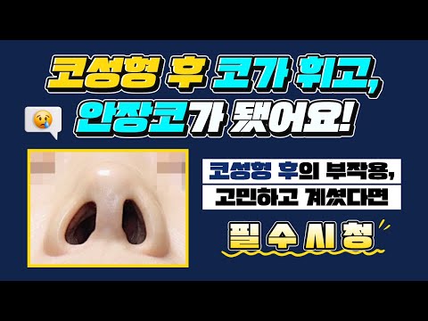 코 성형 후에 코가 휘고 안장코가 됐어요!