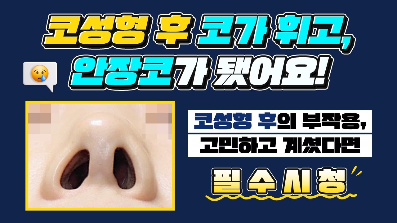 코 성형 후에 코가 휘고 안장코가 됐어요! 썸네일