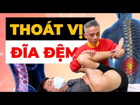 Thoát Vị Đĩa Đệm TÊ BUỐT XUỐNG CHÂN - GIẢI PHÁP KHẨN Trước Khi Quá Muộn!