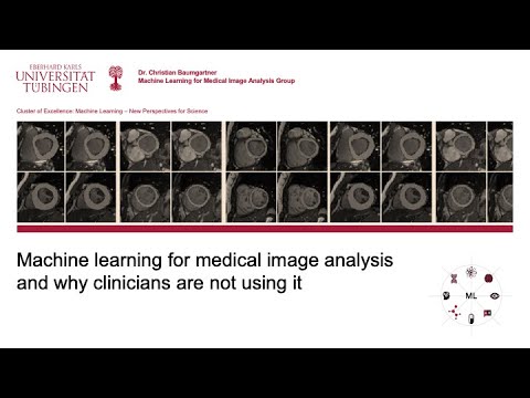 C. Baumgartner: Machine learning for medical image analysis and why clinicians are not using it