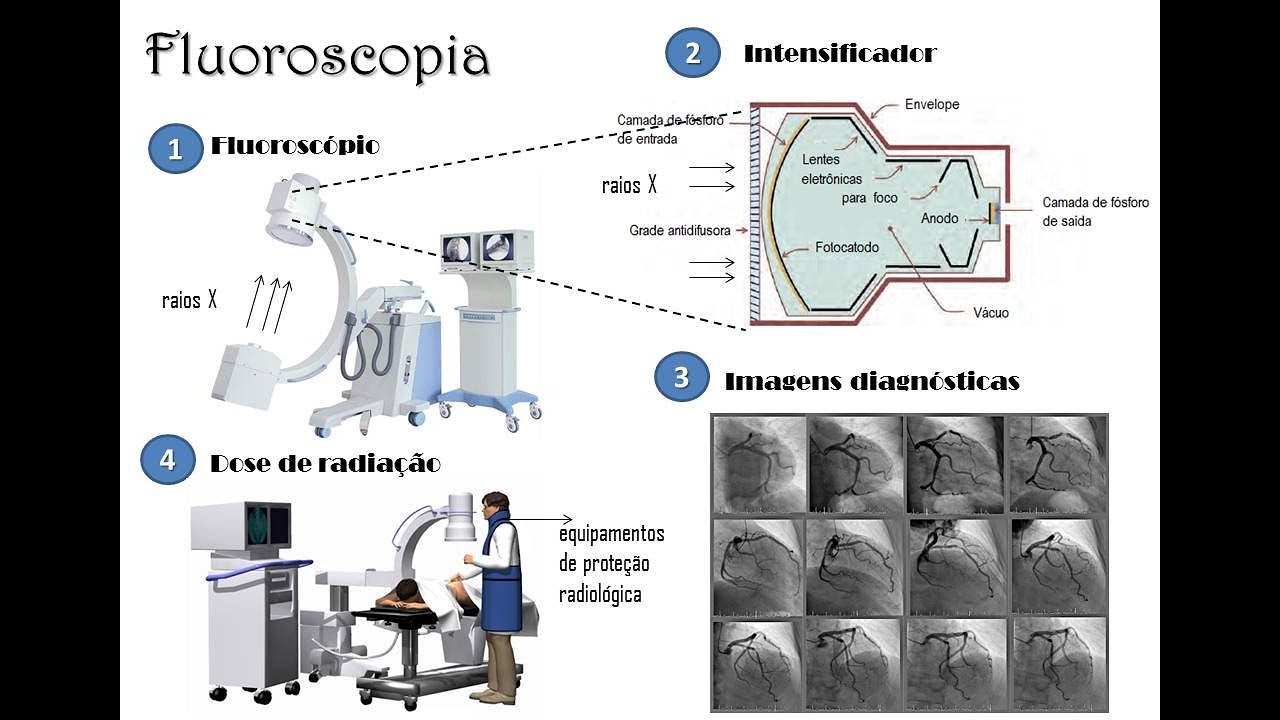 Fluoroscopia - Tópicos gerais