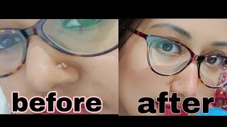 how to remove nose piercing bump??