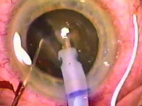 download lagu mp3 mp4 Tomahawk Chopper, download mp3 Tomahawk Chopper free downloadn, video klip Tomahawk Chopper