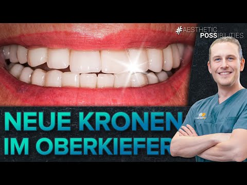 Kronenerneuerung - Vollkeramik im Oberkiefer | Freshup einer Patientin