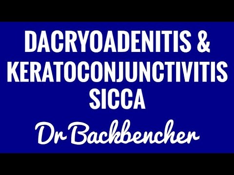 Dacryoadenitis, Keratoconjunctivits Sicca (Dry Eye Syndrome) - Ophthalmology - YouTube