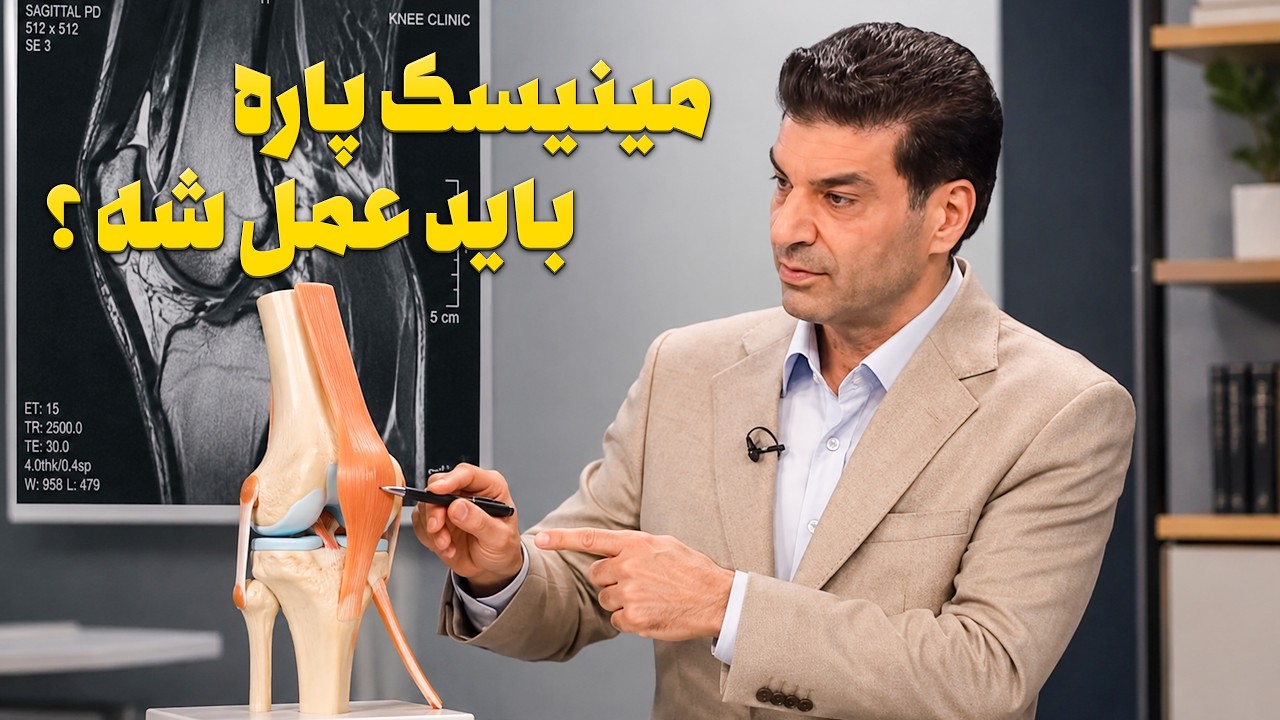 علائم خطرناک پارگی مینیسک زانو / از جراحی آرتروسکوپی تا تقویت عضلات چهارسر
