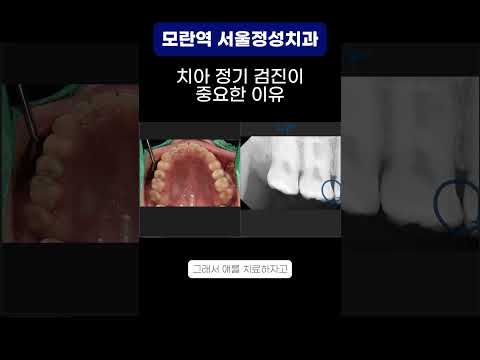 땡큐성형외과 Clips