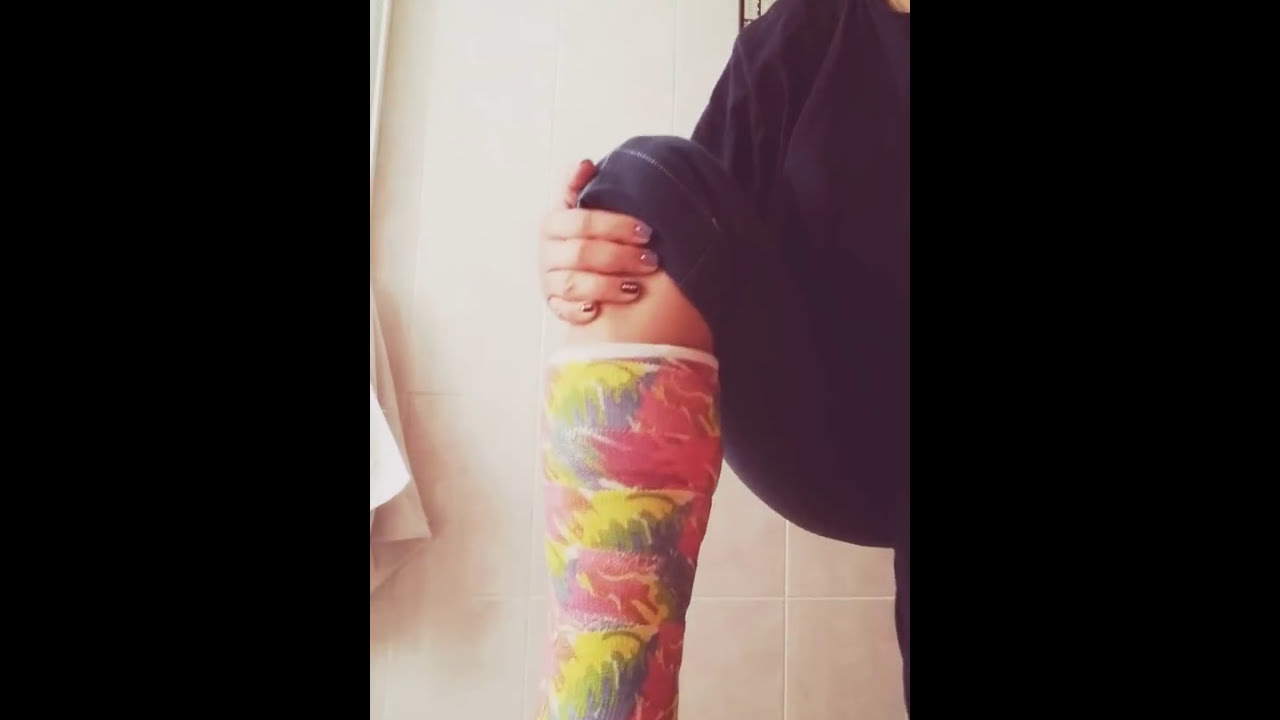 Watch Cómo bañarme con yeso o escayola en el pie Now Cómo bañarme con yeso o escayola en el pie