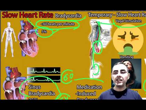 Slow Heart Rate Causes (Bradycardia Causes); Bradycardia symptoms, signs and treatment