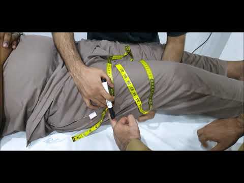 Skill Station: Above knee amputation