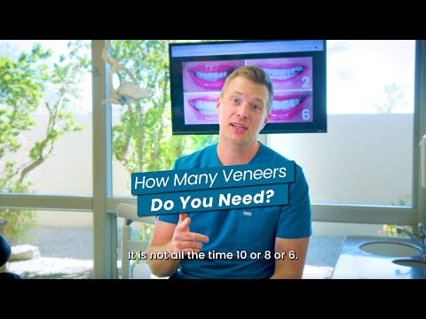 How Many Veneers Do You Really Need? (It Might Be Fewer Than You Think)