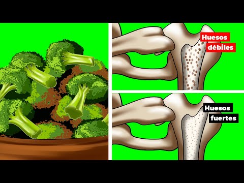 Evita La Osteoporosis Consumiendo Estos 15 Alimentos