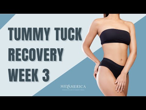Tummy Tuck Recovery   3 Week Post Op