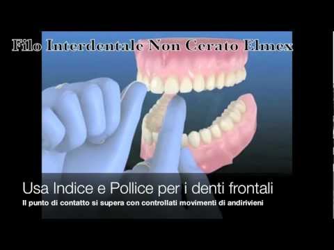Igiene Orale (Interdentale)