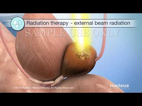 Normal prostate volume cc