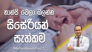 How a Cesarean Section is performed -    ඔබ (�