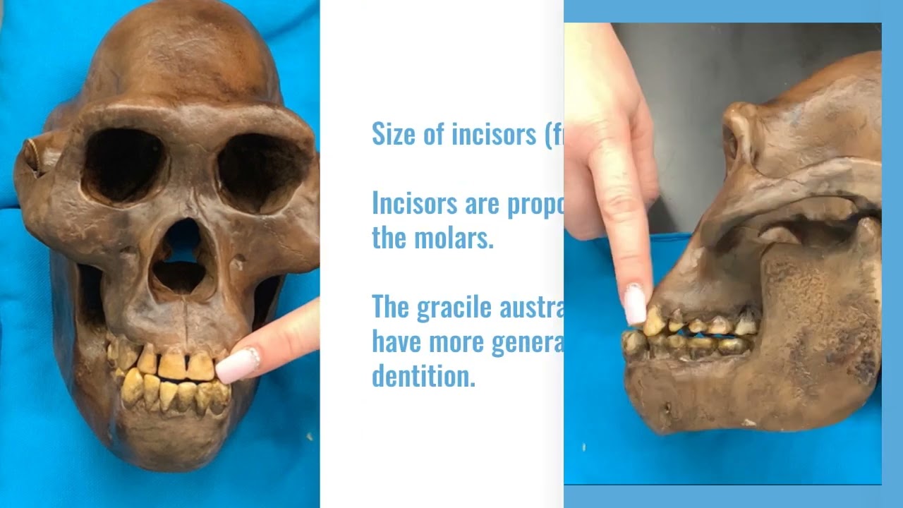 Australopithecus afarensis Cranial Features