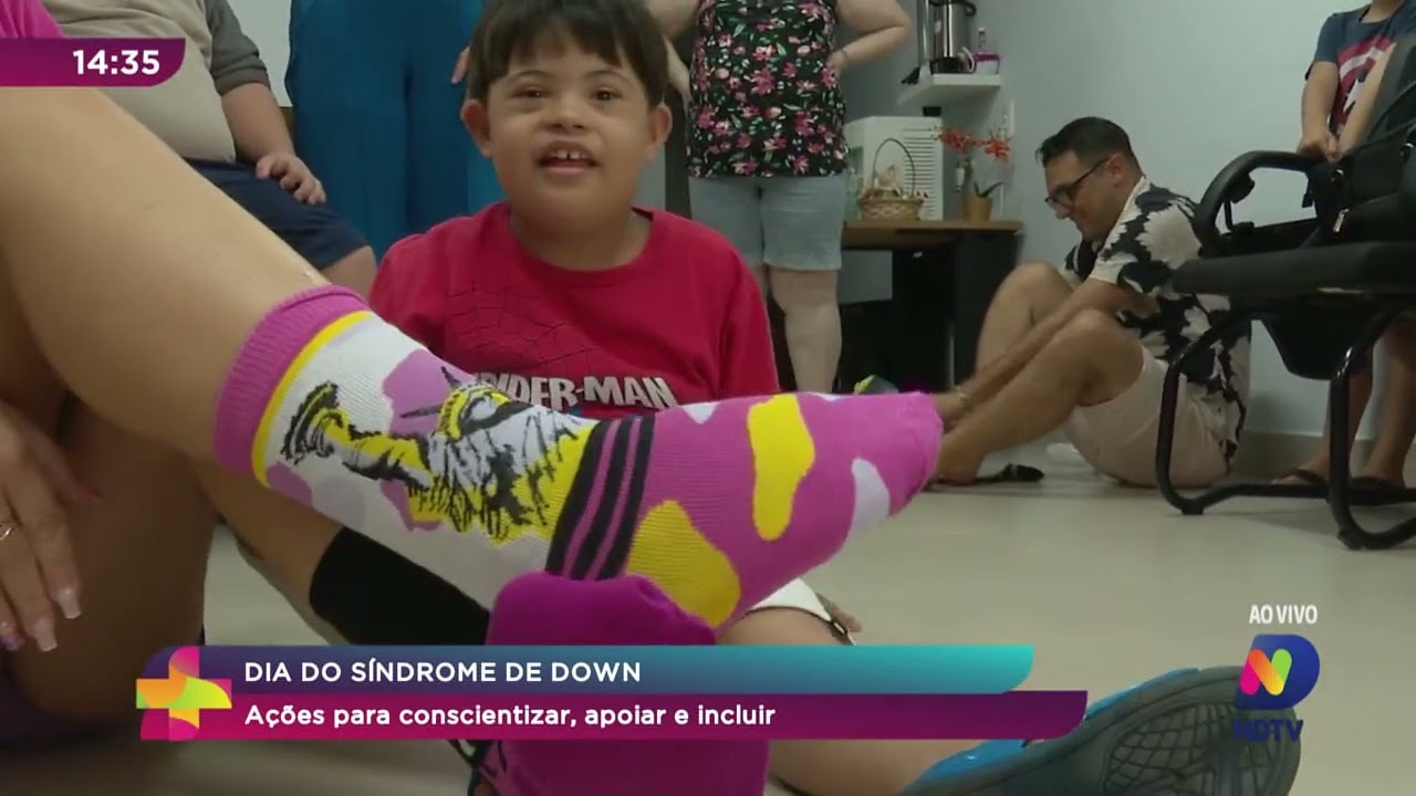 Uso de meias diferentes alerta para Síndrome de Down