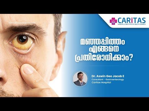 How to prevent jaundice