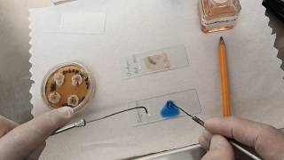 Montaje de hongos para verlos en el microscopio