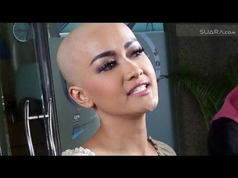 Cerita Ayu Ting Ting Kenapa Jupe Bikin Botak Rambutnya