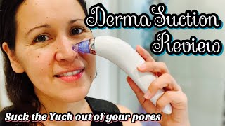 DERMA SUCTION TOOL REVIEW //  Suck the Yuck Out of Your Pores
